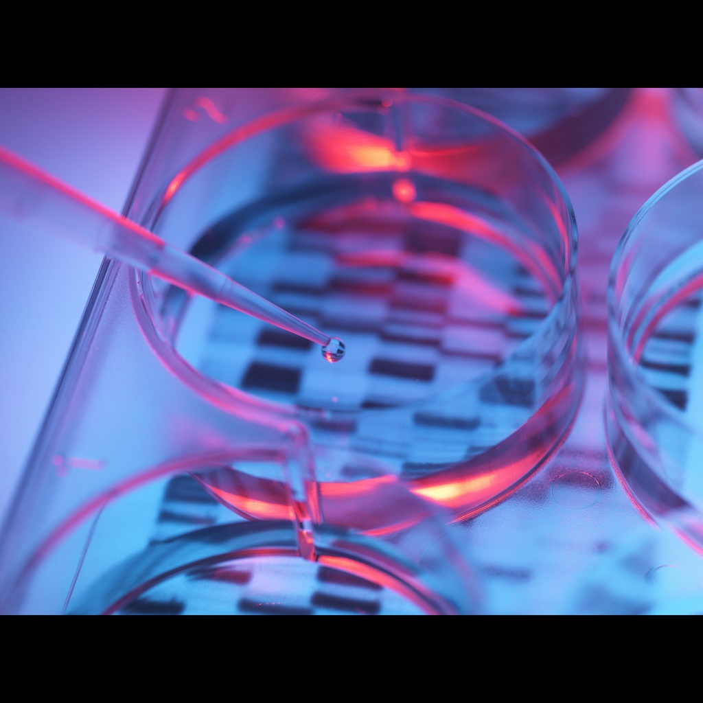 [0556-MBC036-R] Amplirun® Neisseria Meningitidis Sg A DNA Control size:10,000size:20,000 c/µL